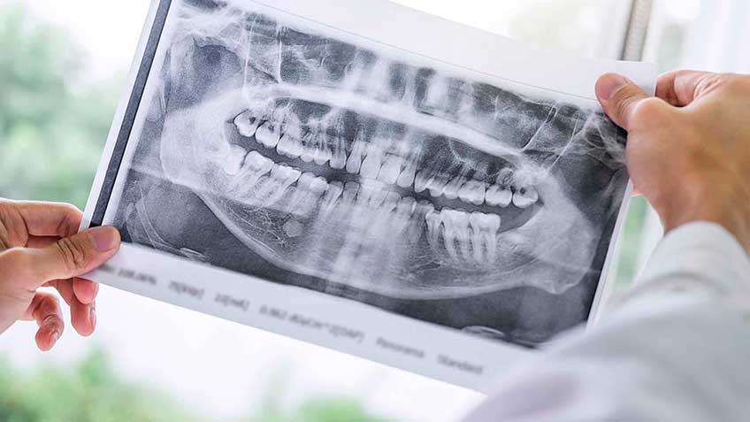 odontologia-neurofocal-patologias-dentales-como-campo-de-interferencia Encuentros con la Salud Serie 1 - Odontologia Neurofocal | HitLive